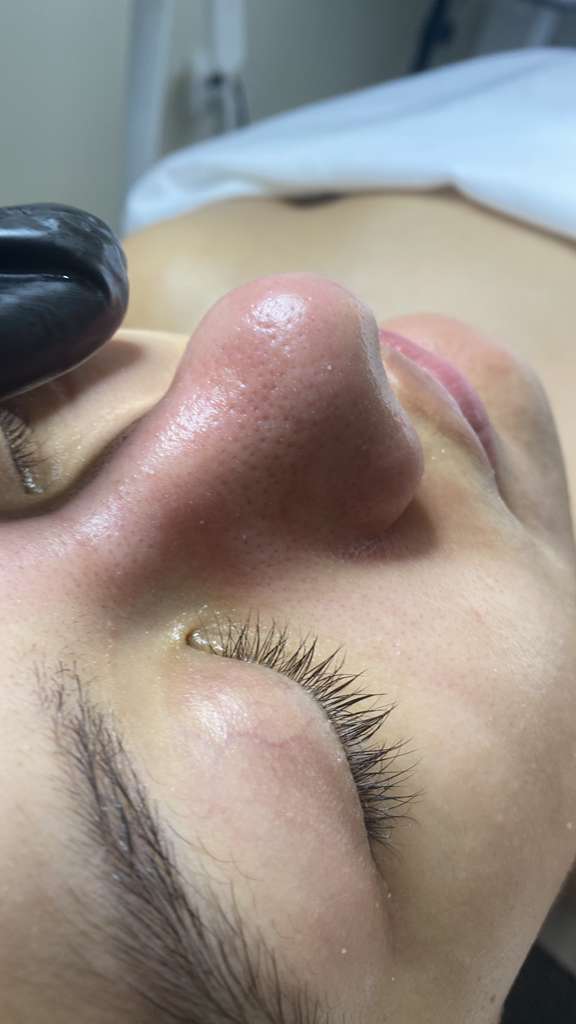 Deep Facial Cleansing