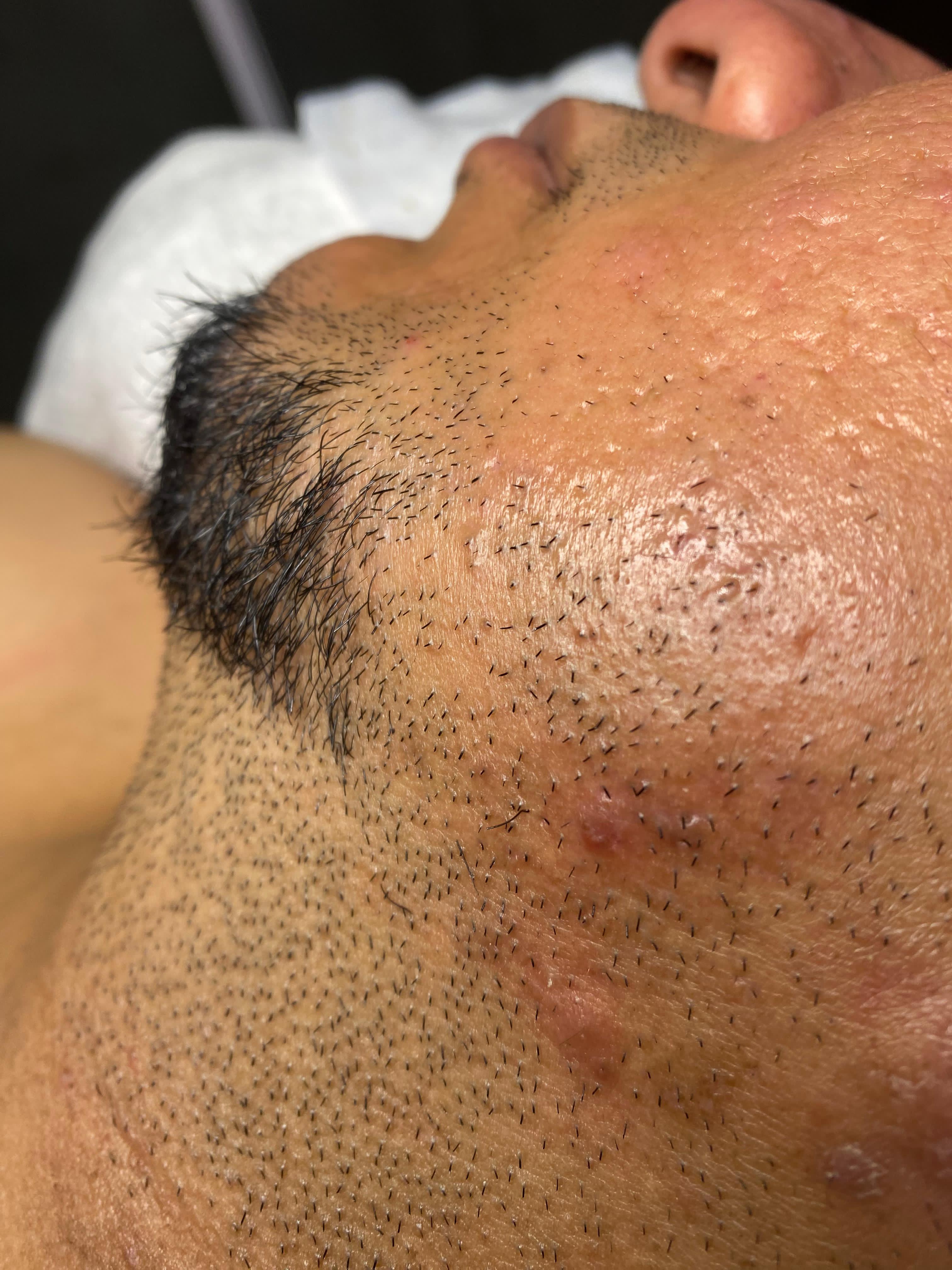 Rejuvenating Facial